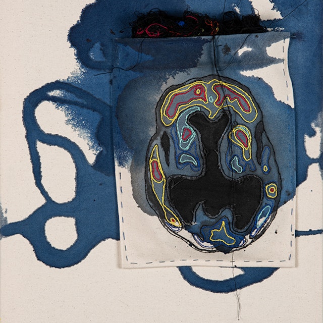 Dementia Stain (darkness visible)